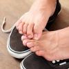 Svrab stopala - uzroci i liječenje Zašto vas stopala svrbe noću